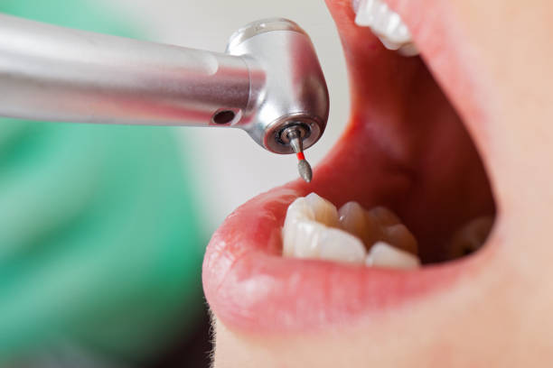 Best Emergency Dental Services for Seniors in Mackinaw, IL